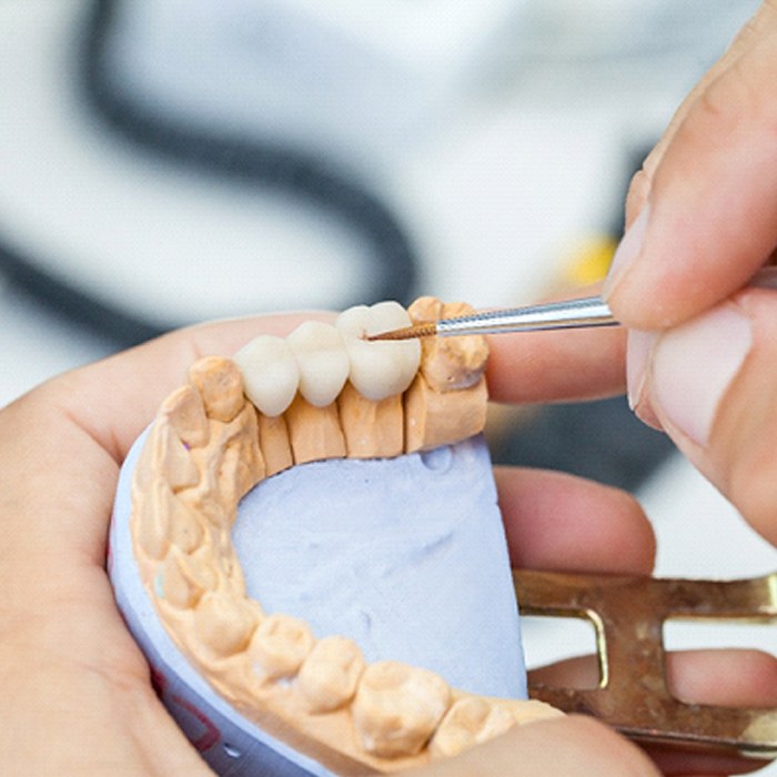 dentist crafting a dental bridge placed on a model of a mouth