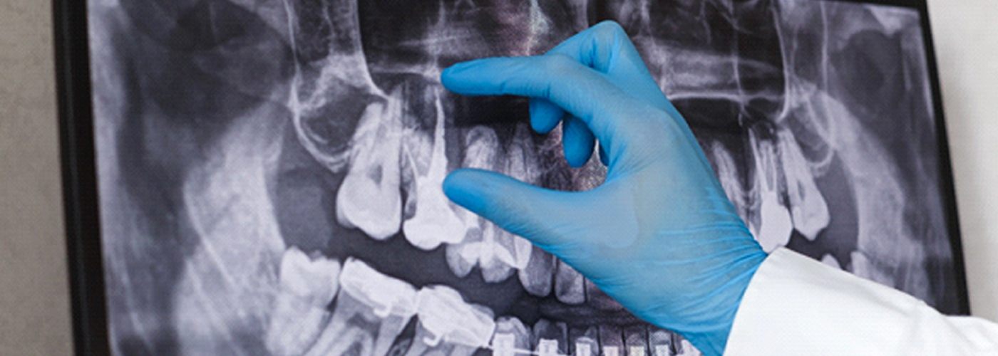 dentist pointing to a digital X-ray