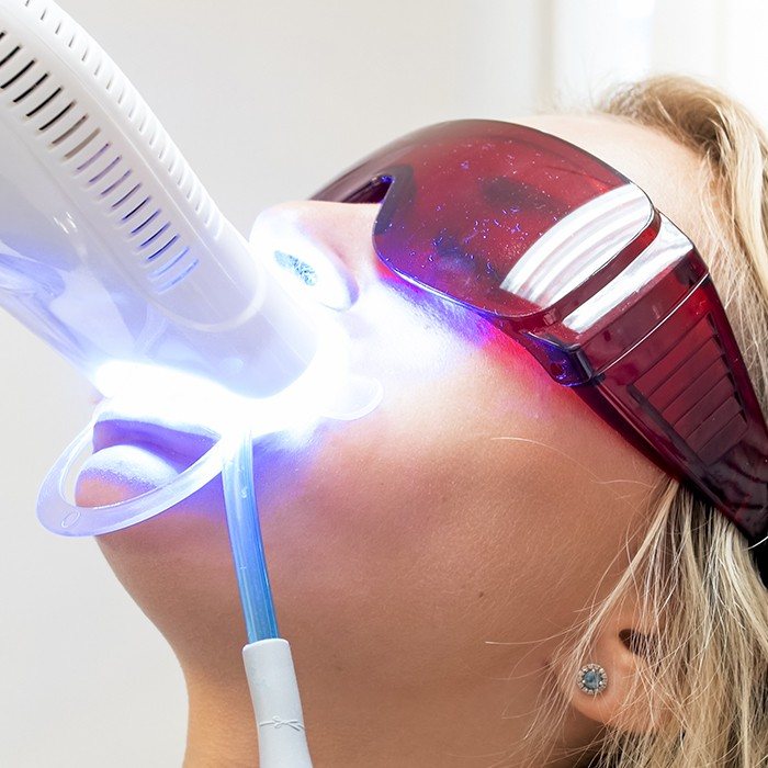 Patient receiving in-office teeth whitening