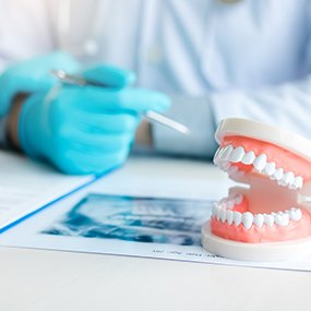 Model of teeth lying on X-rays on dentist's desk