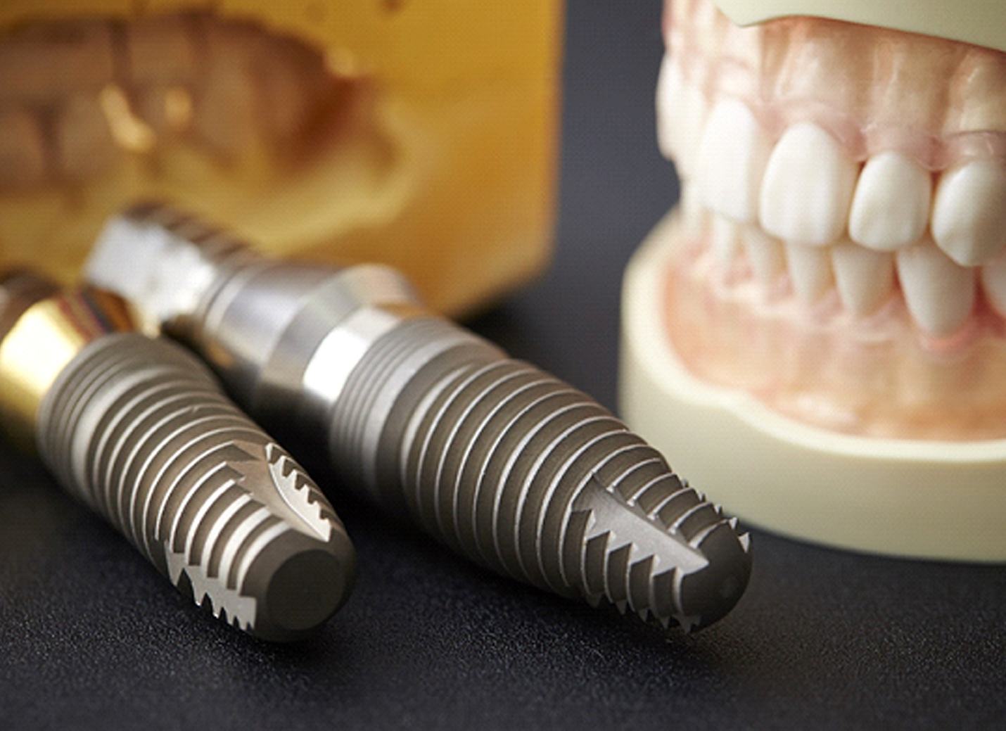 titanium implants sitting next to a model of a mouth