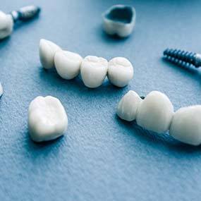 different types of dental implants in Lexington on blue background
