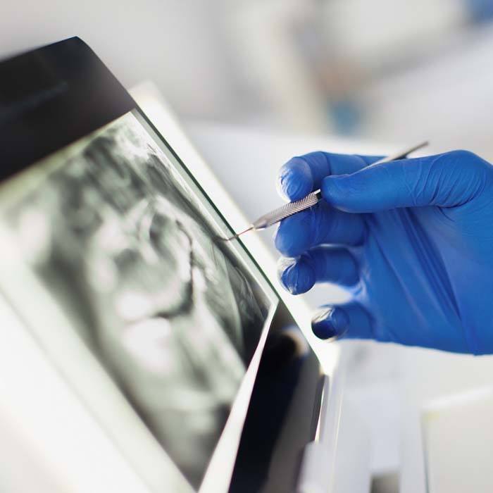 Lexington implant dentist pointing to dental X-ray