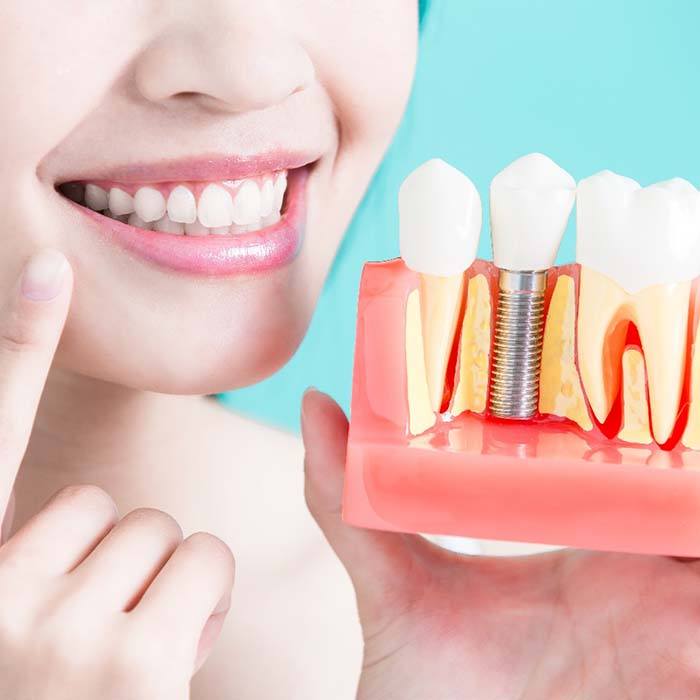 Closeup of patient holding model of dental implants in Lexington