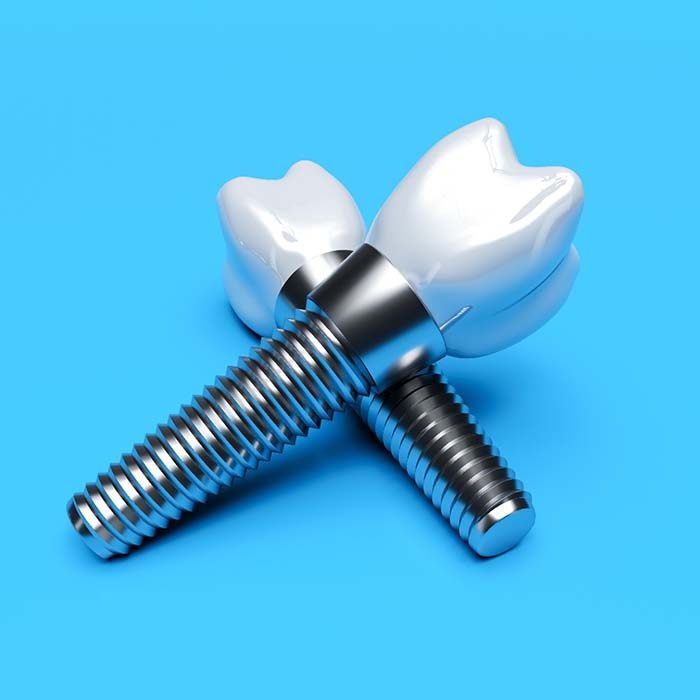 Dental implants in Lexington on blue background