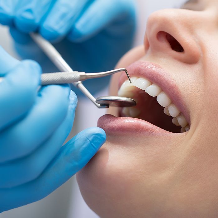 Closeup of patient during dental exam