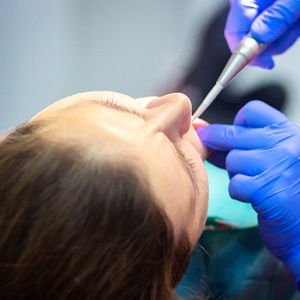 A patient undergoing IV sedation in Lexington during an appointment