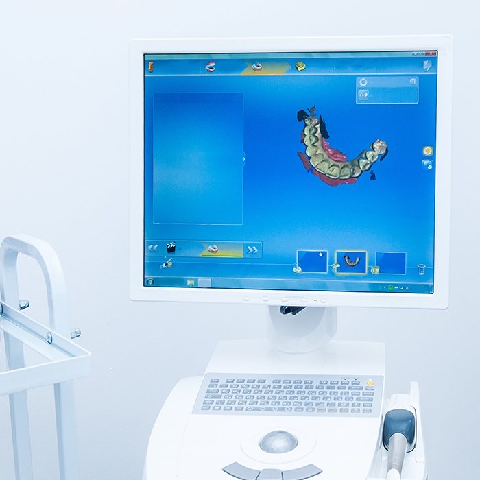 Digital dental impressions on computer