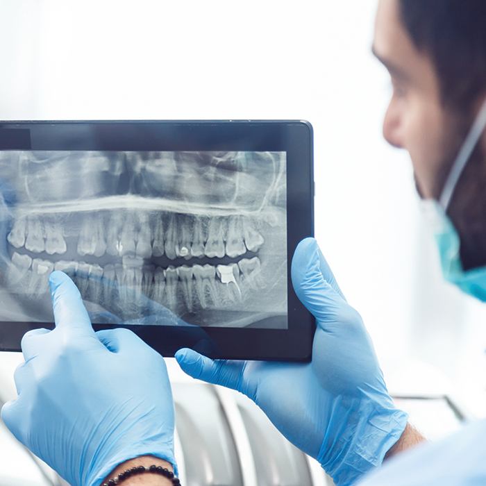 Dental x-rays on tablet computer