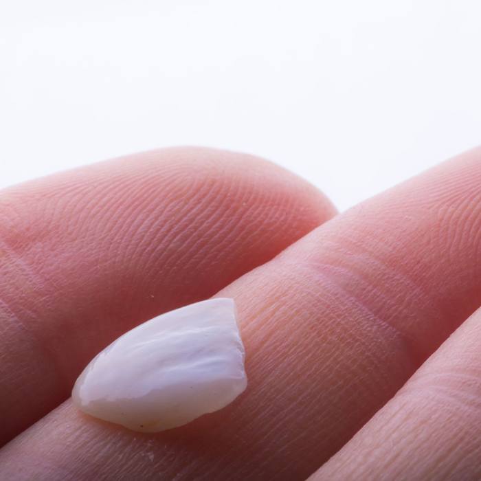 Close-up of hand holding a veneer in Lexington, KY