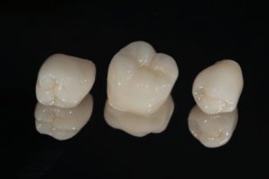 three dental crowns in Lexington against black background