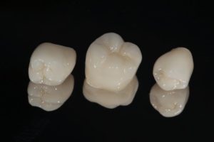 three dental crowns in Lexington against black background 