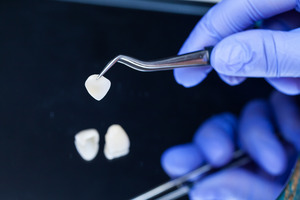 Close-up of dentist picking up veneers